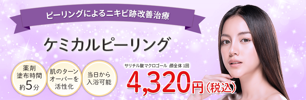 ケミカルピーリング