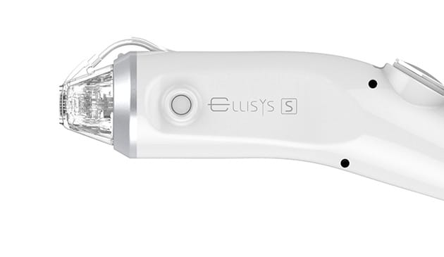 ダウンタイムを短くする