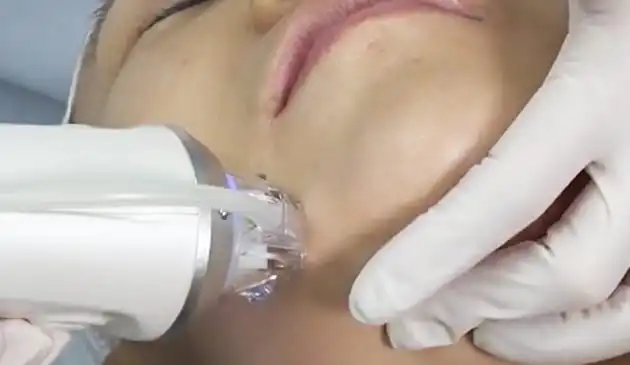 真空バキューム機能