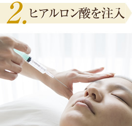 2.ヒアルロン酸を注入