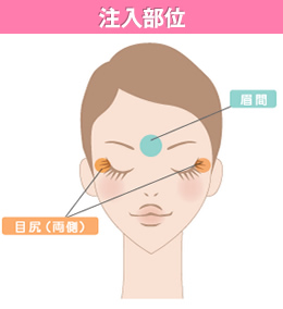 注入部位