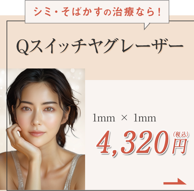 Qスイッチヤグレーザー