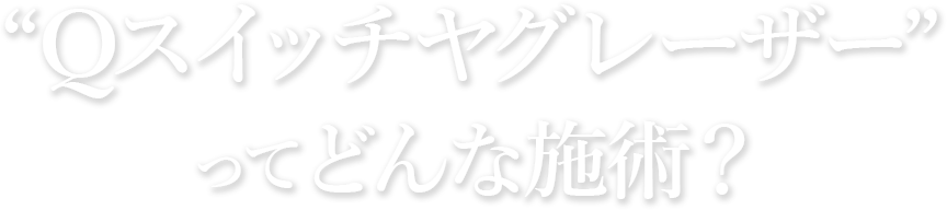 Qスイッチヤグレーザーってどんな施術