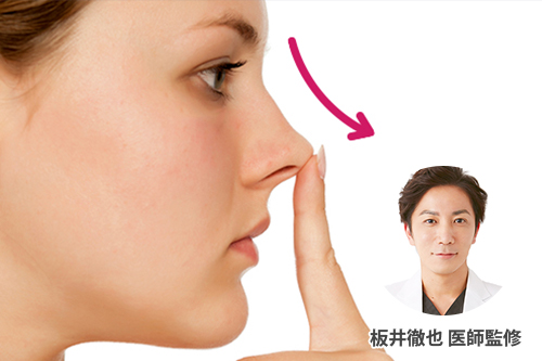 鼻先を高くしたい そんなお悩みを解決する方法を解説 医師監修 Shinagawa Beauty Navi