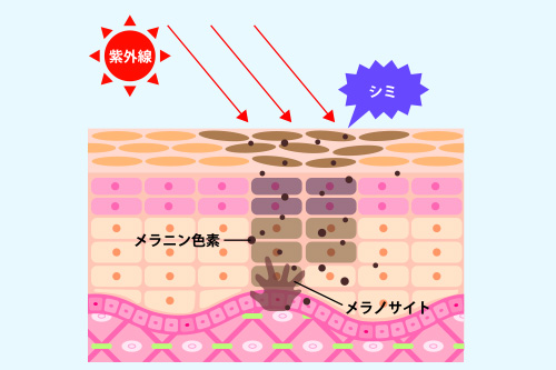 トラネキサム 酸 副作用