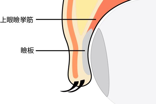 切らない施術！二重の埋没法ってどんな手術？