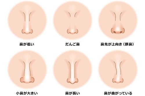 鼻の種類