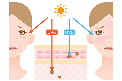 紫外線による皮膚への影響