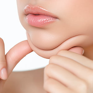 渋谷院の小顔治療