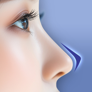 2位_フレックス・ノーズ®【画像】