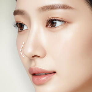 スーパーナチュラル鼻先修整【画像】