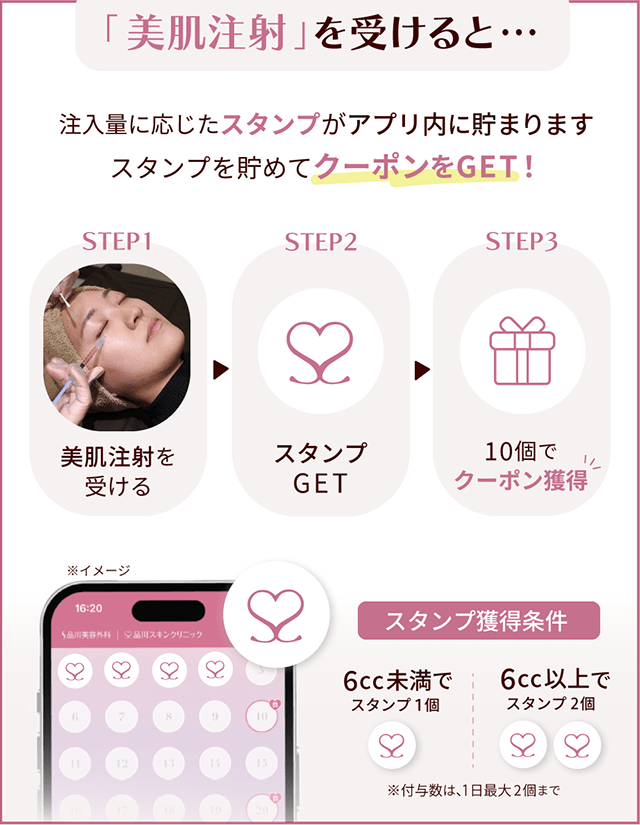 「美肌注射」を受けると… 注入量に応じたスタンプがアプリ内に貯まります スタンプを貯めてクーポンをGET！ STEP1：美肌注射を受ける STEP2：スタンプGET STEP3：10個でクーポン獲得 スタンプ獲得条件：6cc未満でスタンプ1個 6cc以上でスタンプ2個 ※付与数は、1日最大2個まで