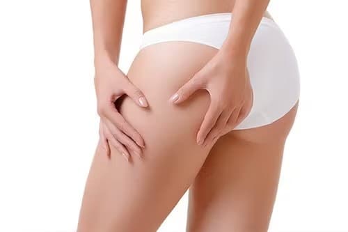 【脂肪吸引のチェックポイント1】自分に必要・合っているか？