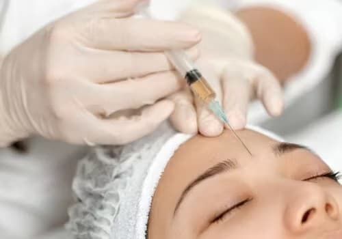 注入法のメリット、デメリット