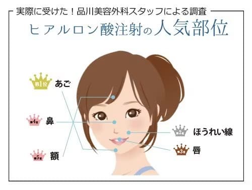 実際に受けた！品川美容外科スタッフによる調査 ヒアルロン酸注射の人気部位 第1位：あご 第2位：ほうれい線 第3位：唇 第4位：鼻 第5位：額