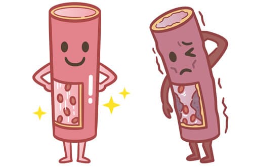 ヘパリン類似物質を使うときの注意点