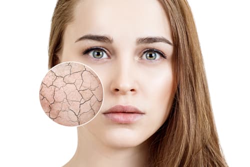 さまざまなトラブルを招く肌の乾燥