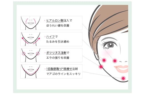 輪郭タイプ別！お悩みとおすすめの治療法（３）エラ張りタイプ