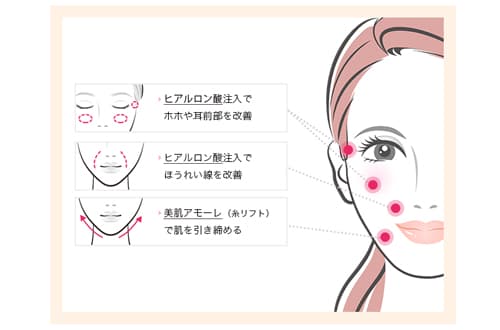 輪郭タイプ別！お悩みとおすすめの治療法（２）面長タイプ