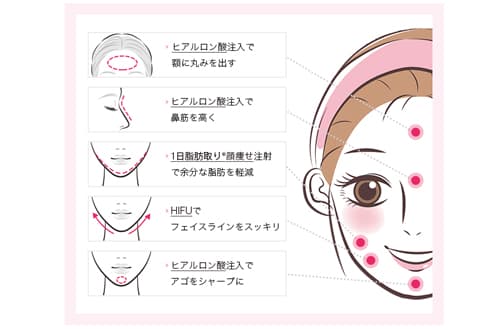 輪郭タイプ別！お悩みとおすすめの治療法（１）丸顔タイプ