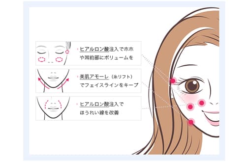 輪郭タイプ別！お悩みとおすすめの治療法（４）逆三角タイプ