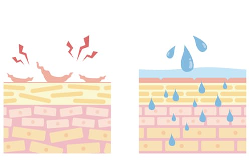 混合肌（インナードライ）の原因