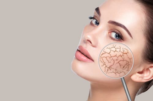 脂っぽいけれど乾燥している？混合肌（インナードライ）とは