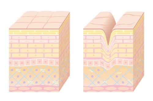 頬がこける原因