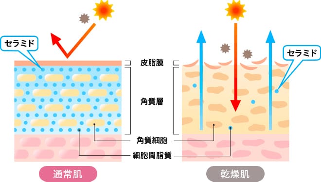 通常肌と乾燥肌の比較【画像】