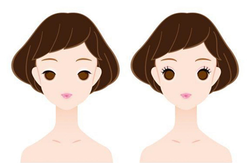 切らない施術！二重の埋没法ってどんな手術？