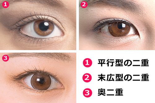 主な二重の種類