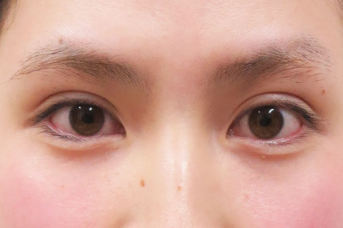 おおらかで懐の深い人物に憧れる方→【大きなパッチリ目（二重まぶた）】