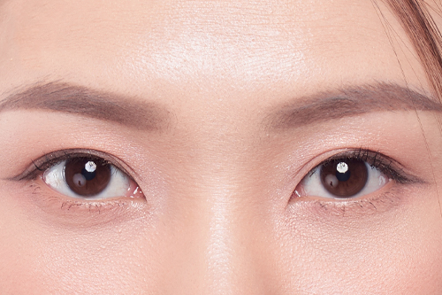 幅の狭い平行二重