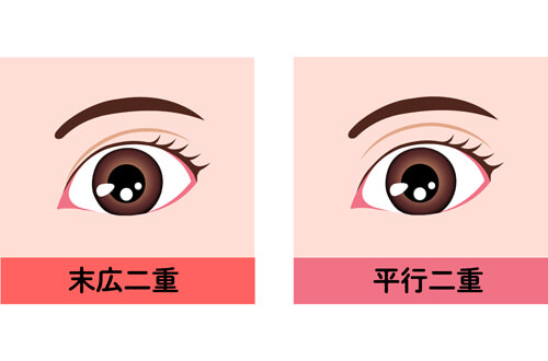 二重は大きく分けて2種類