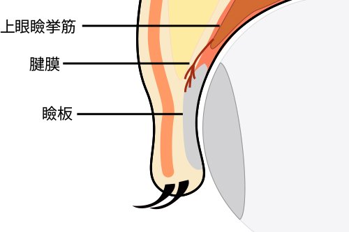 奥二重ってどんなまぶたのこと？