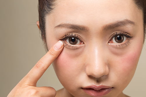 目元のたるみやクマ改善に効果的なエイジングケア