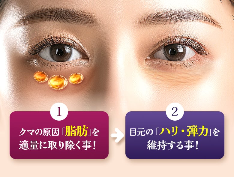 ①クマの原因「脂肪」を適量に取り除く事！②目元の「ハリ・弾力」を維持する事！