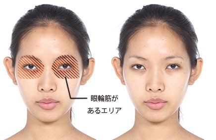 どうにか消したい目の下のクマ、その種類とは？