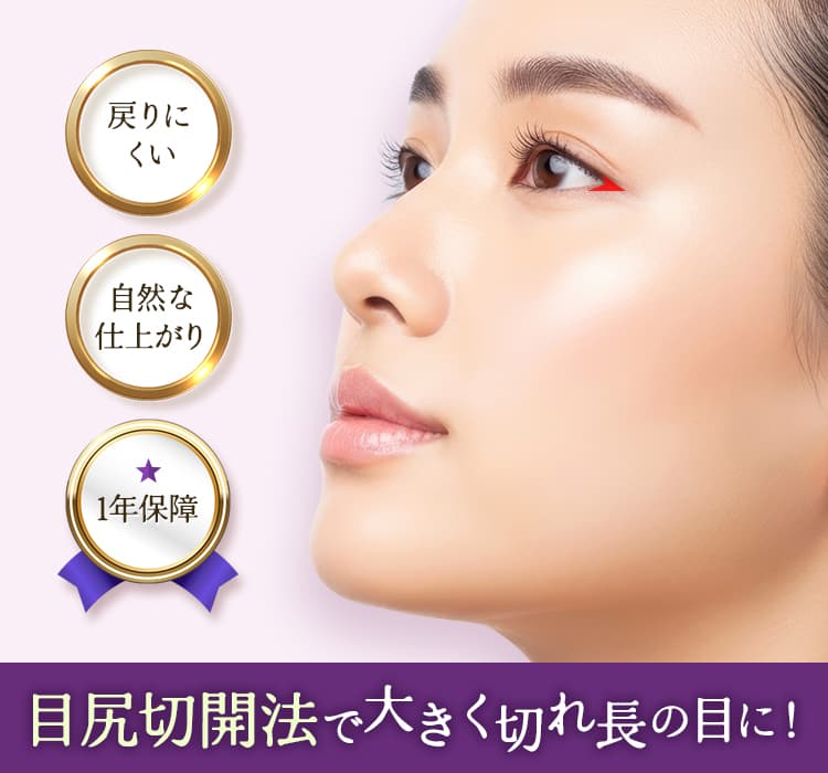 戻りにくい 自然な仕上がり 1年保障 目尻切開法で大きく切れ長の目に！