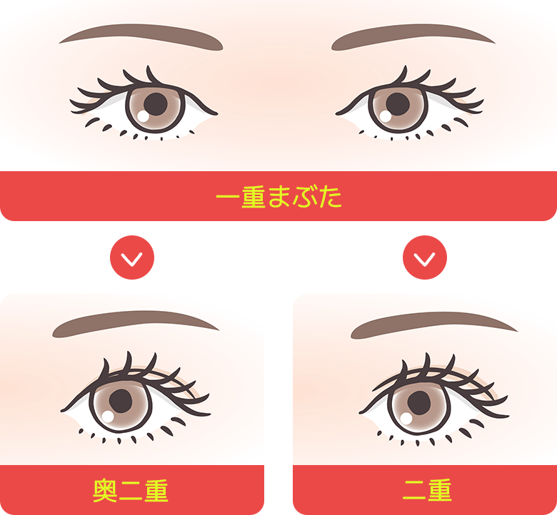 一重まぶた / 奥二重 / 二重