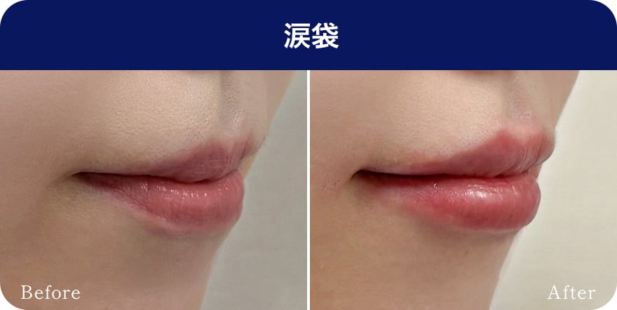 唇【画像】