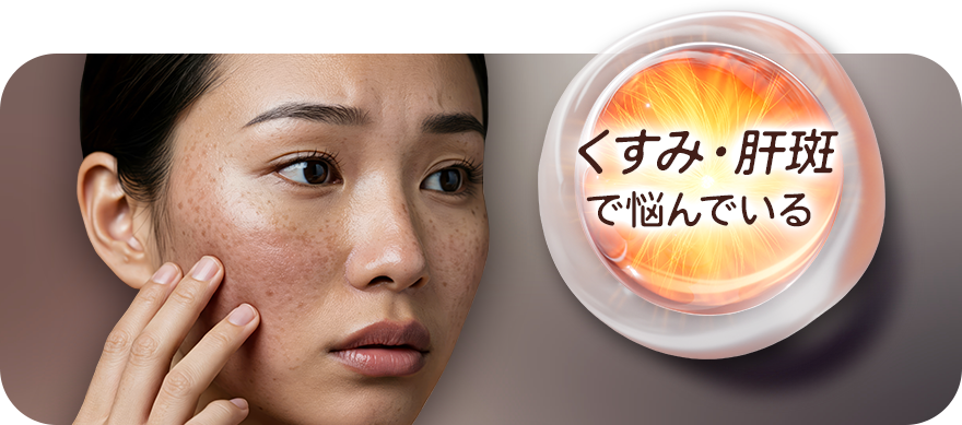 くすみ・肝斑で悩んでいる