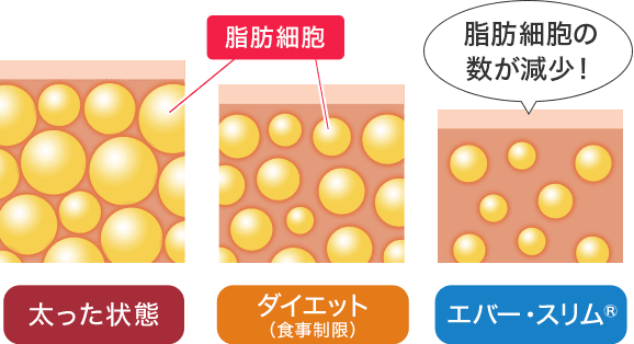 脂肪細胞は太った状態よりもダイエット（食事制限）時のほうが少なく、それよりもエバー・スリム®のほうが少ないです