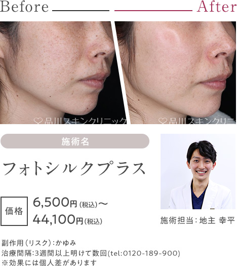 フォトシルクプラス