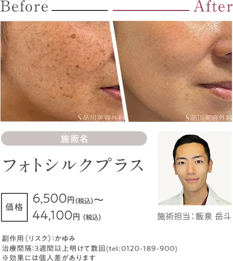 フォトシルクプラス