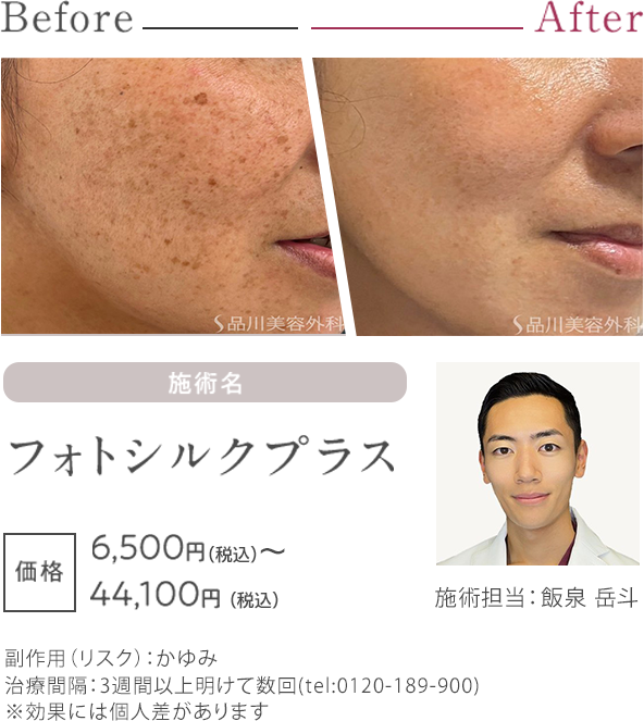 フォトシルクプラス