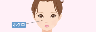 ホクロを取りたい！