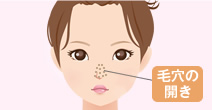 毛穴の開きを治したい！