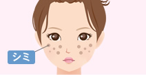 シミを消したい！
