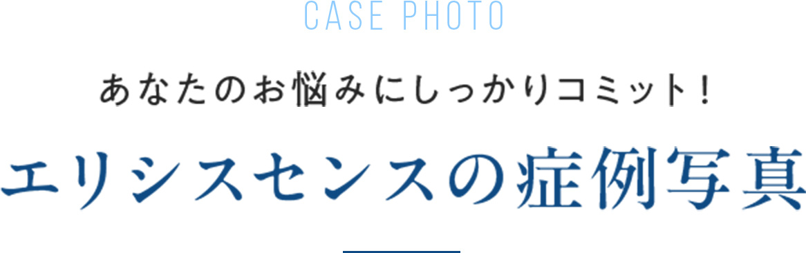 case photo あなたのお悩みにしっかりコミット！ エリシスセンスの症例写真